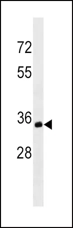 MS4A1/CD20 Mouse Monoclonal Antibody - Size: 50µl