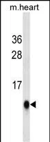 UBL5(Ascites) Mouse Monoclonal Antibody - Size: 50µl