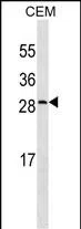 CRP Mouse Monoclonal Antibody - Size: 100µl
