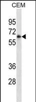 FCGR3A Mouse Monoclonal Antibody - Size: 100µl