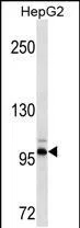 DDR2(Ascites) Mouse Monoclonal Antibody - Size: 50µl
