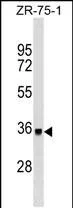 DYT1 Mouse Monoclonal Antibody - Size: 50µl