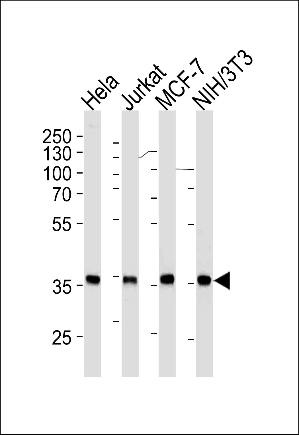NPM1 Mouse Monoclonal Antibody - Size: 50µl