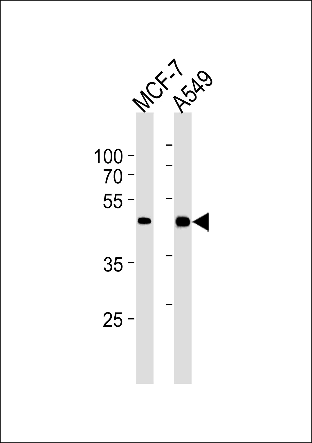 CCRK (N-term) Mouse Monoclonal Antibody - Size: 50µl