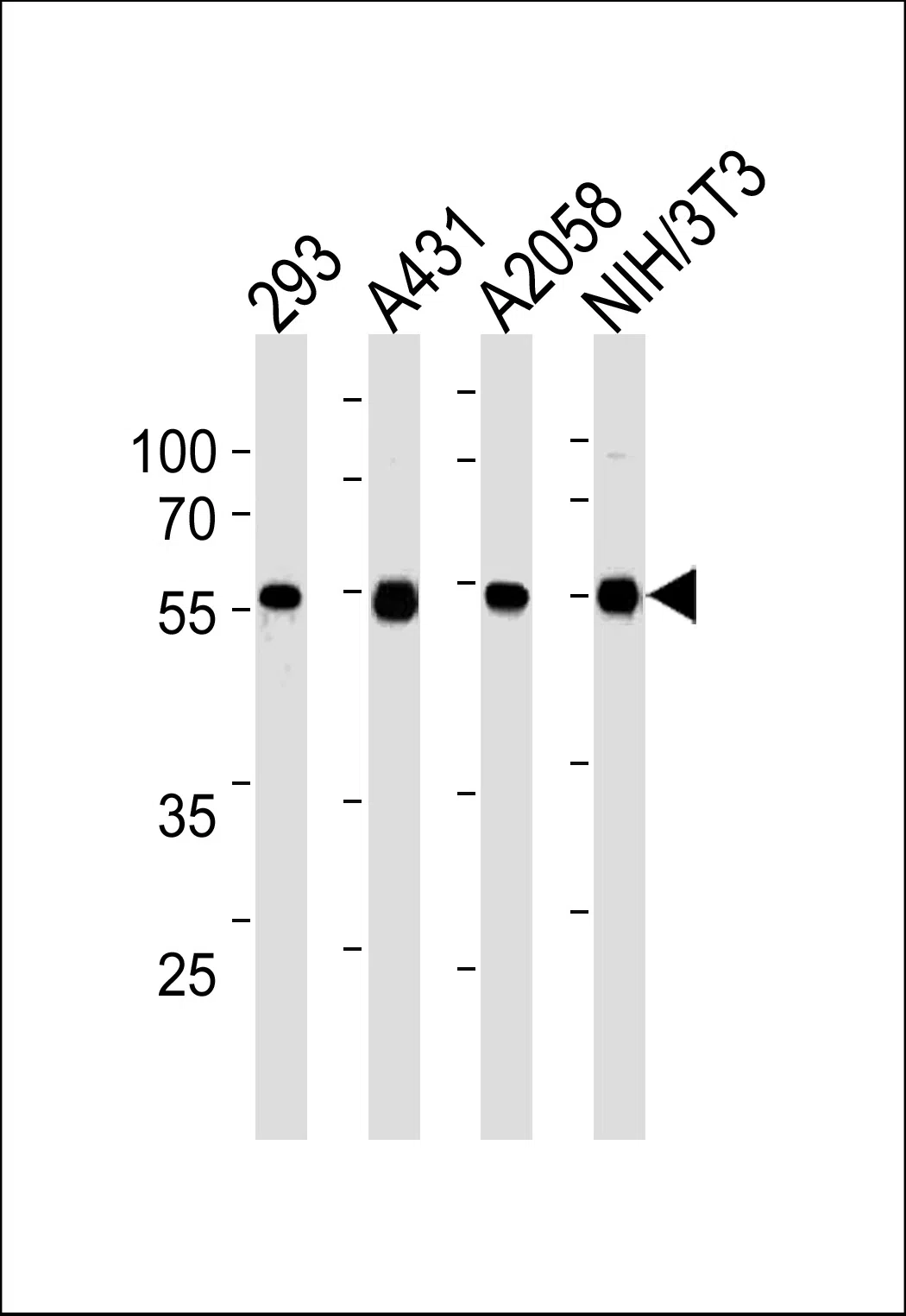TPIPb(Ascites) Mouse Monoclonal Antibody - Size: 50µl