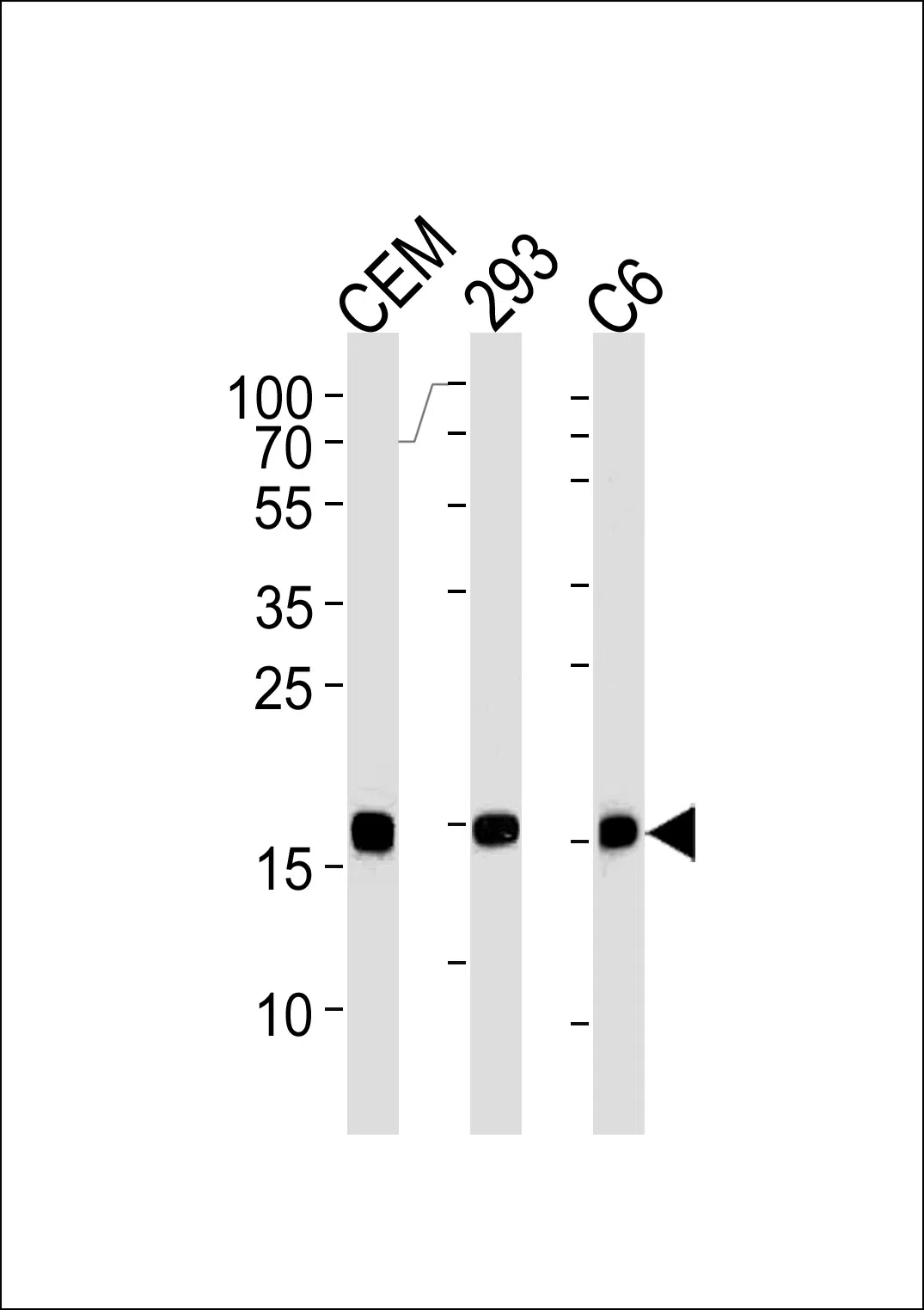 SUMO2 Mouse Monoclonal Antibody - Size: 100µl