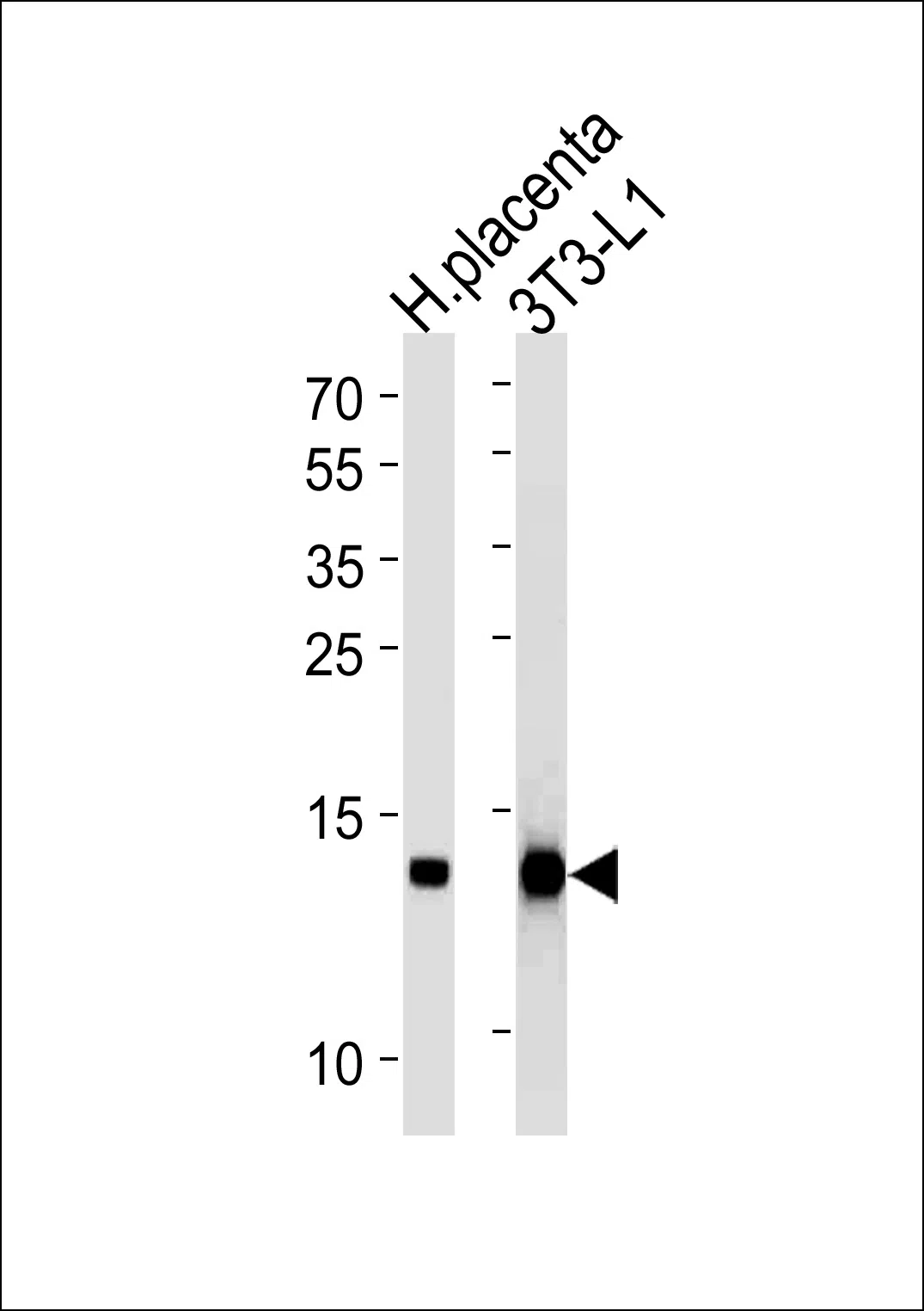 FABP4 Mouse Monoclonal Antibody - Size: 100µl