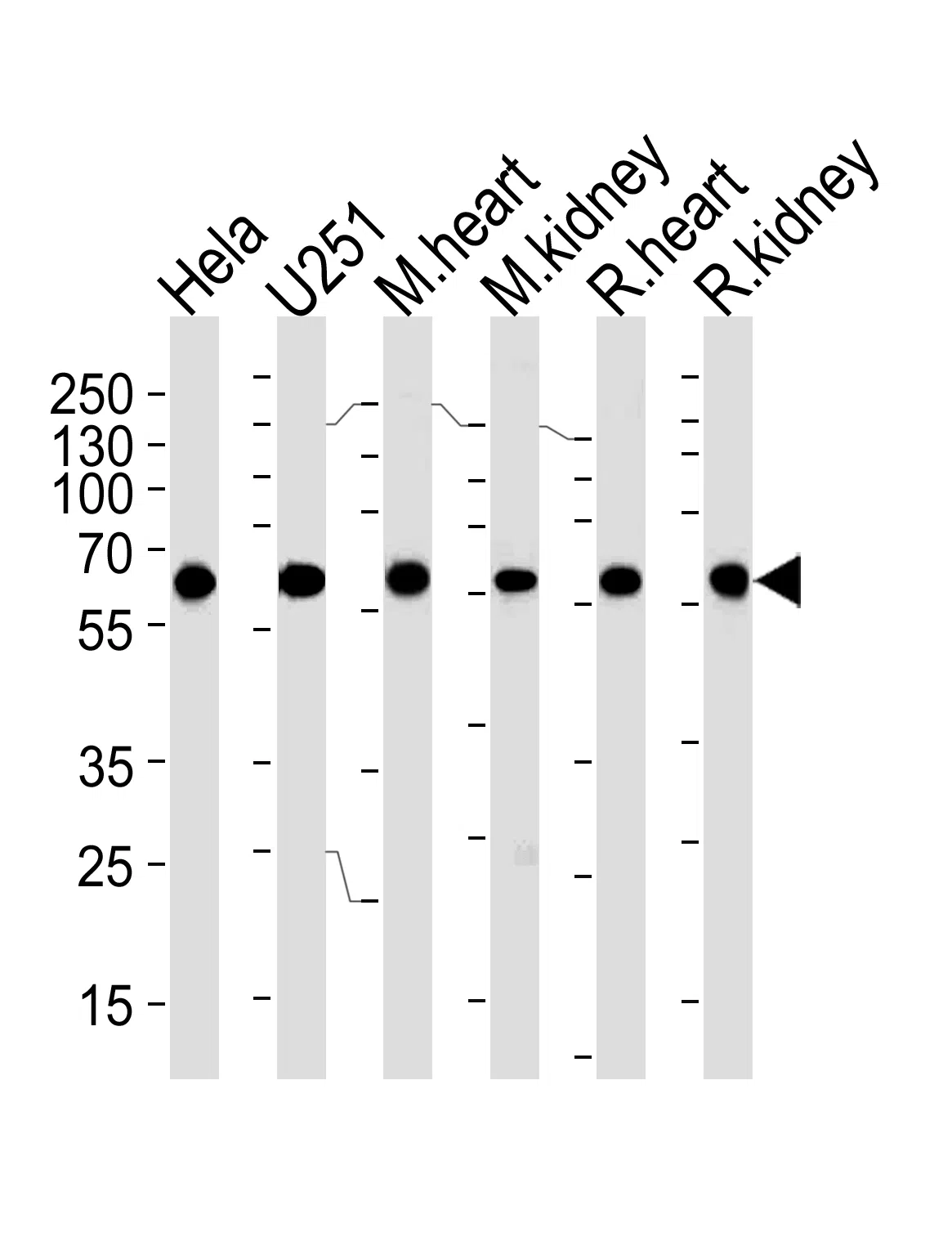 BBS4 Mouse Monoclonal Antibody - Size: 100µl