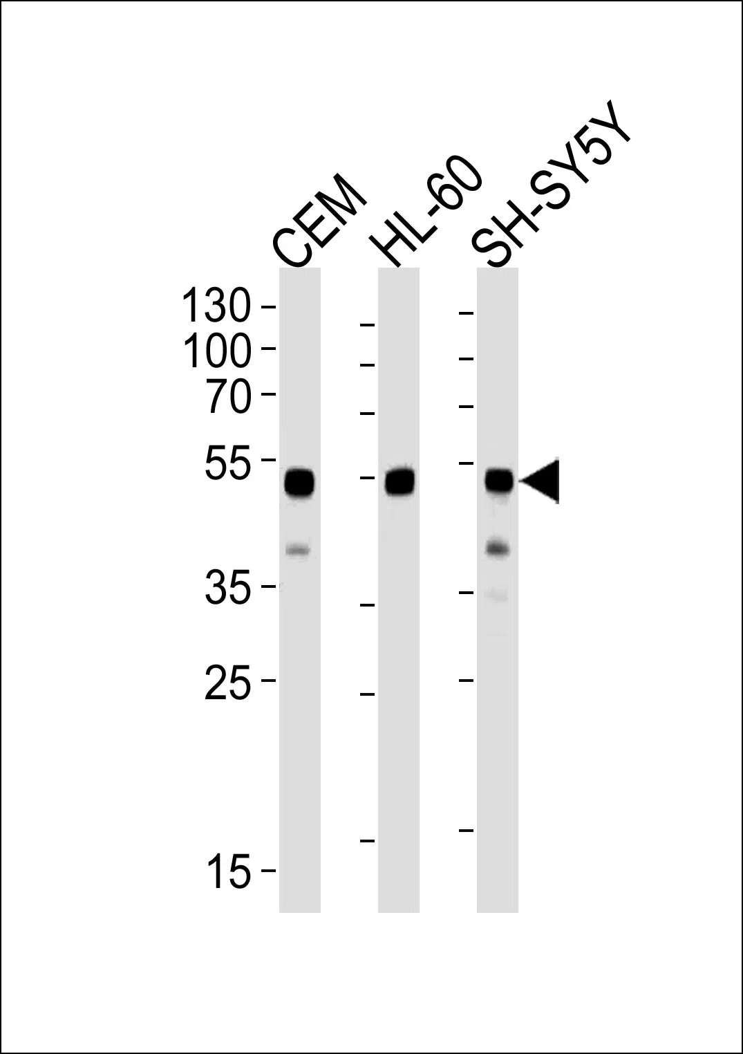 GATA3 Mouse Monoclonal Antibody - Size: 50µl