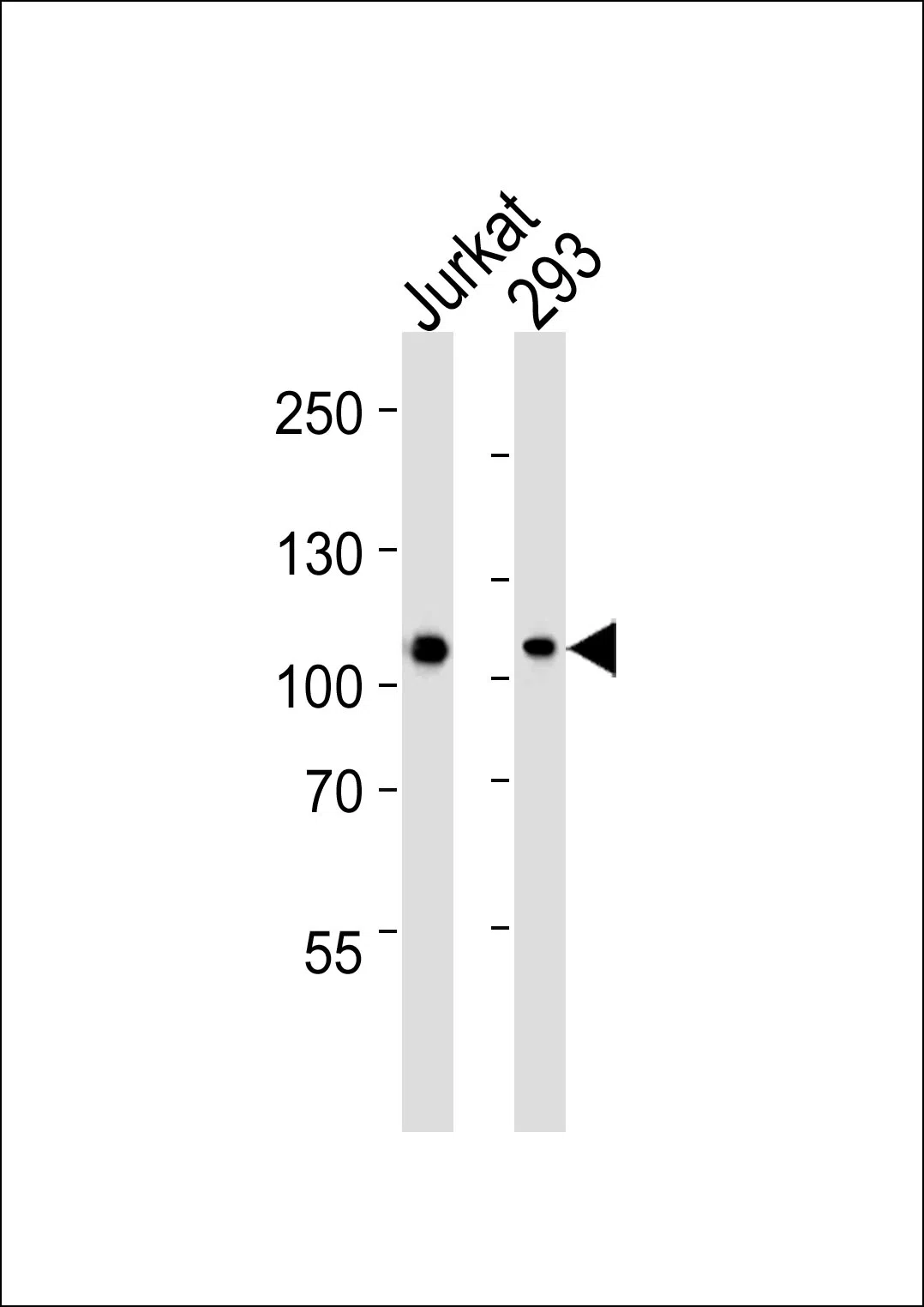MAGED1 Mouse Monoclonal Antibody - Size: 50µl