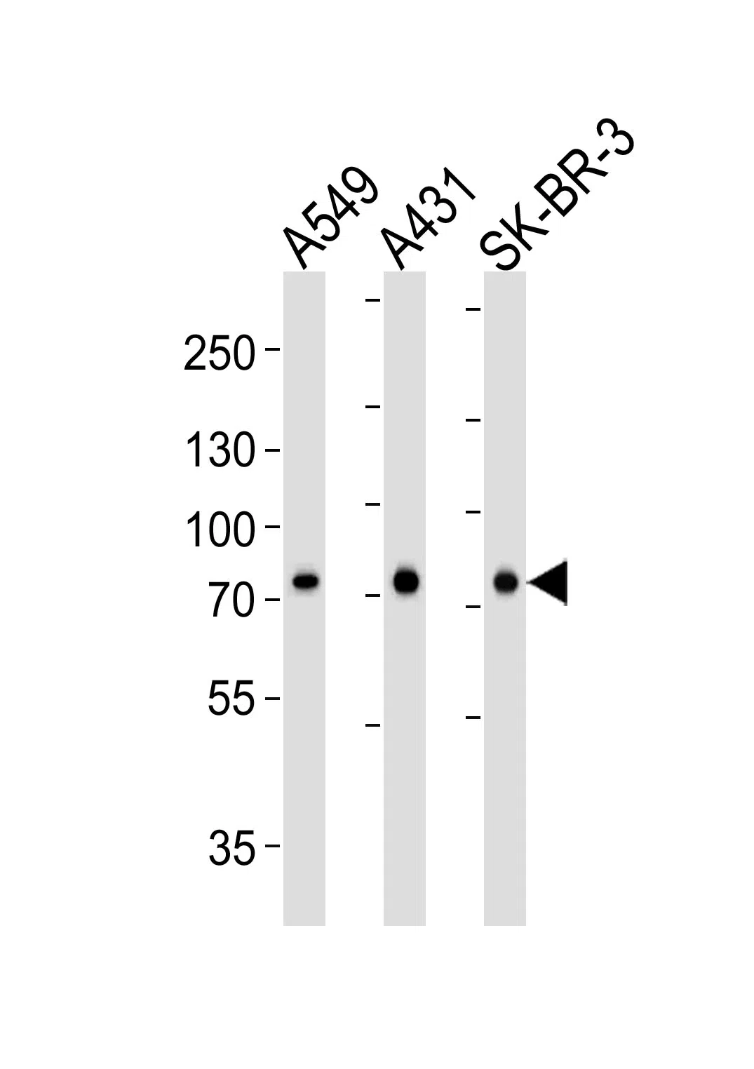 CAPN2 Mouse Monoclonal Antibody - Size: 100µl