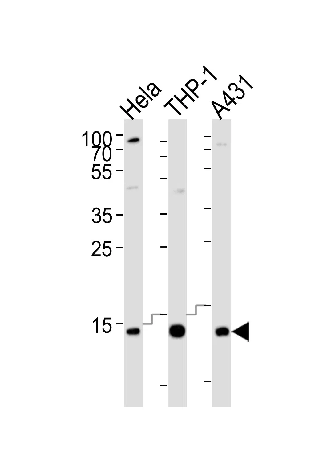 VAMP8 (N-term) Mouse Monoclonal Antibody - Size: 100µl