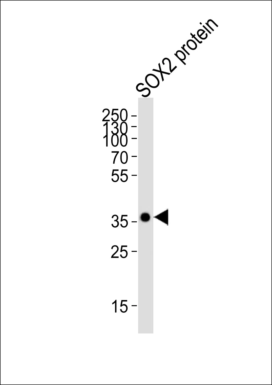 SOX2 Mouse Monoclonal Antibody - Size: 100µl