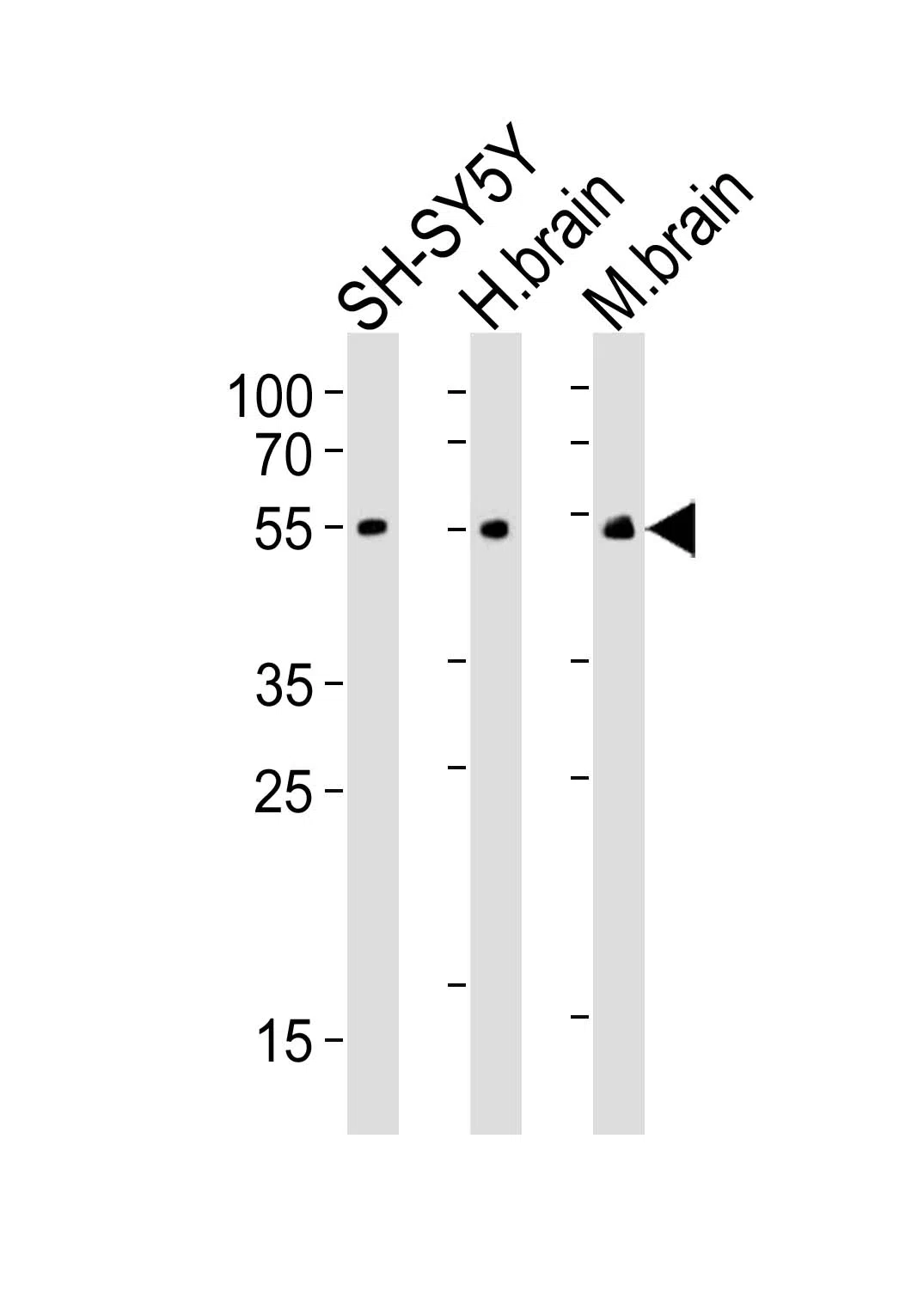 CHRM2 Mouse Monoclonal Antibody - Size: 50µl