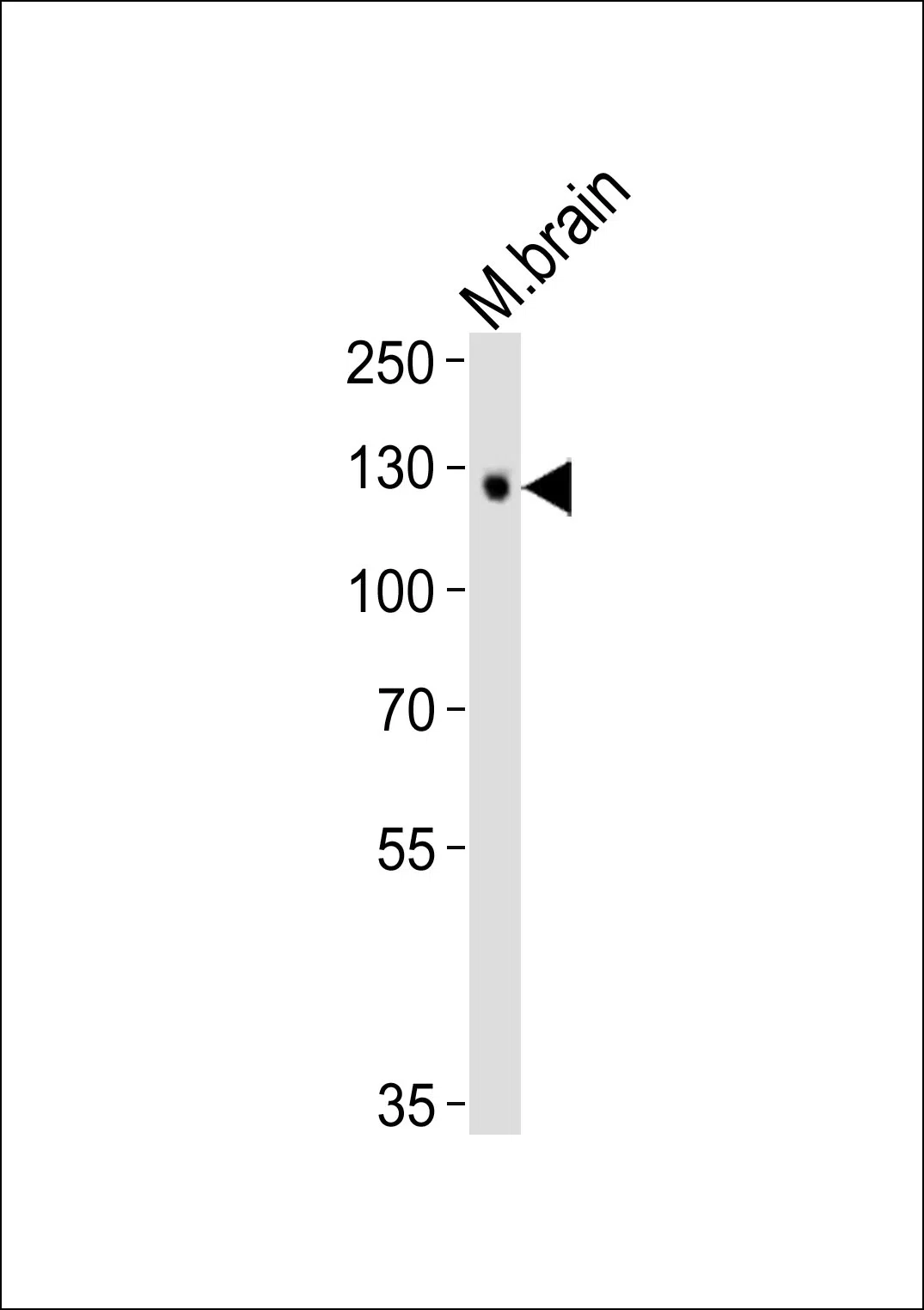 Tyro3 Mouse Monoclonal Antibody - Size: 100µl