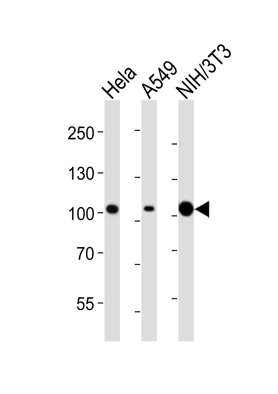 FER Mouse Monoclonal Antibody - Size: 100µl