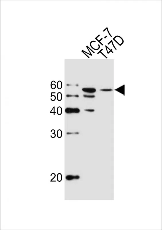 ALDH6A1 Mouse Monoclonal Antibody - Size: 100µl