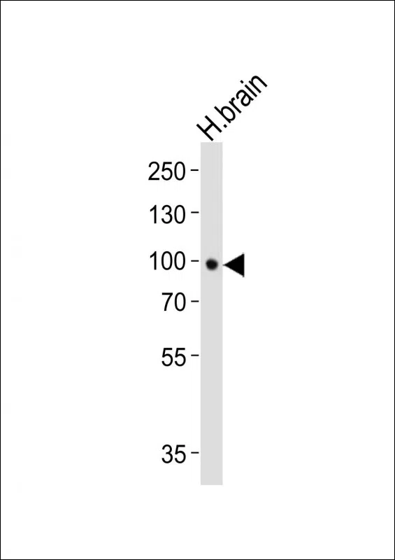 NTRK2 Mouse Monoclonal Antibody - Size: 50µl