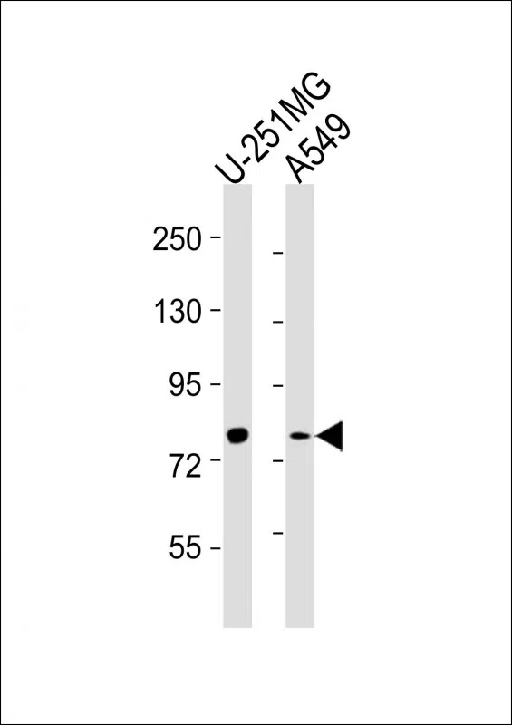 FES Mouse Monoclonal Antibody - Size: 100µl
