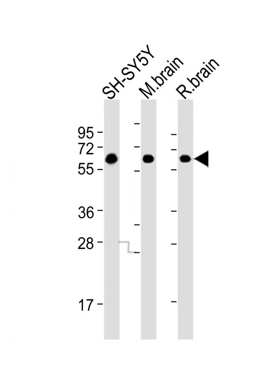 DPYSL5 Mouse Monoclonal Antibody - Size: 100µl