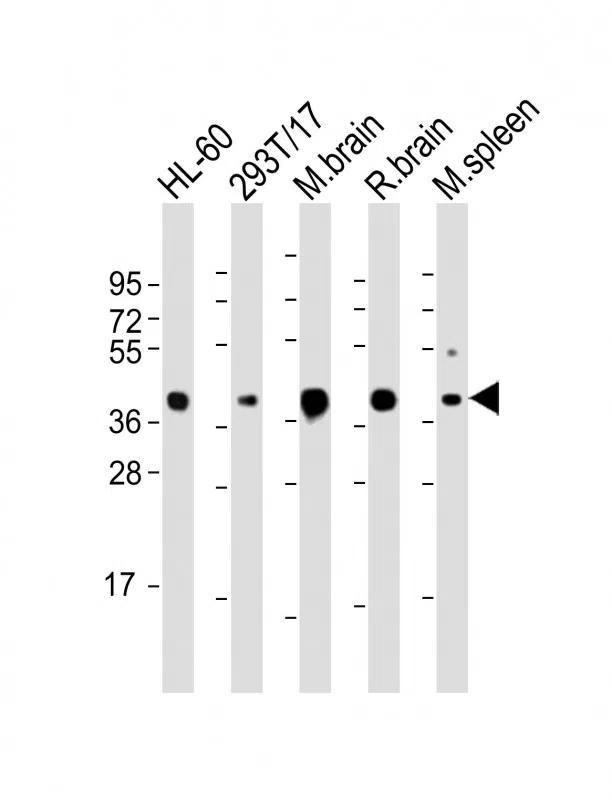 ALDOC Mouse Monoclonal Antibody - Size: 100µl