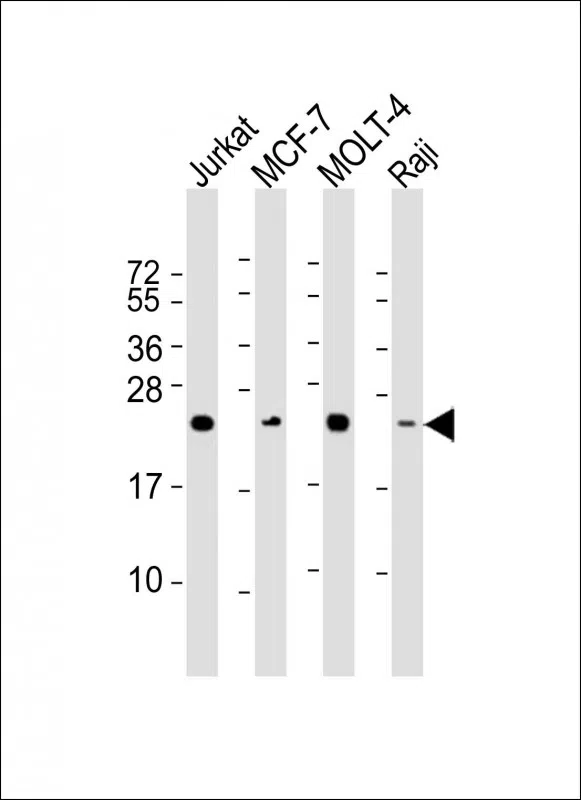 MGMT Mouse Monoclonal Antibody - Size: 50µl
