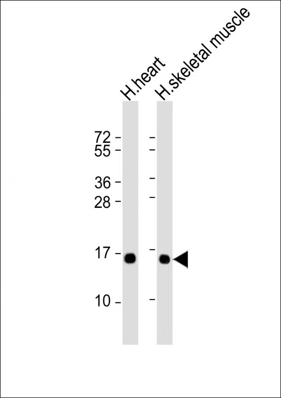 TUSC2 Mouse Monoclonal Antibody - Size: 100µl