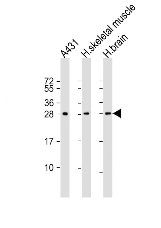 DENR Mouse Monoclonal Antibody - Size: 100µl