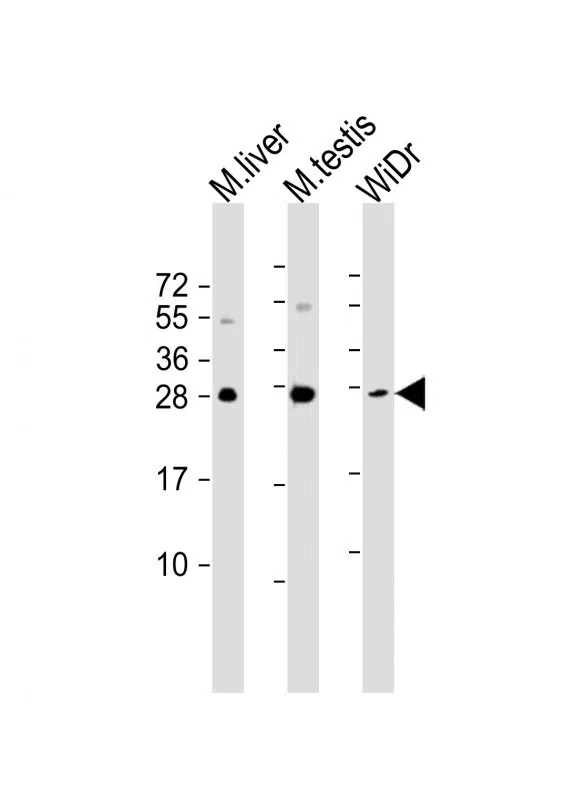 CDX1 Mouse Monoclonal Antibody - Size: 50µl