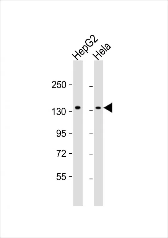 RBM6 Mouse Monoclonal Antibody - Size: 100µl