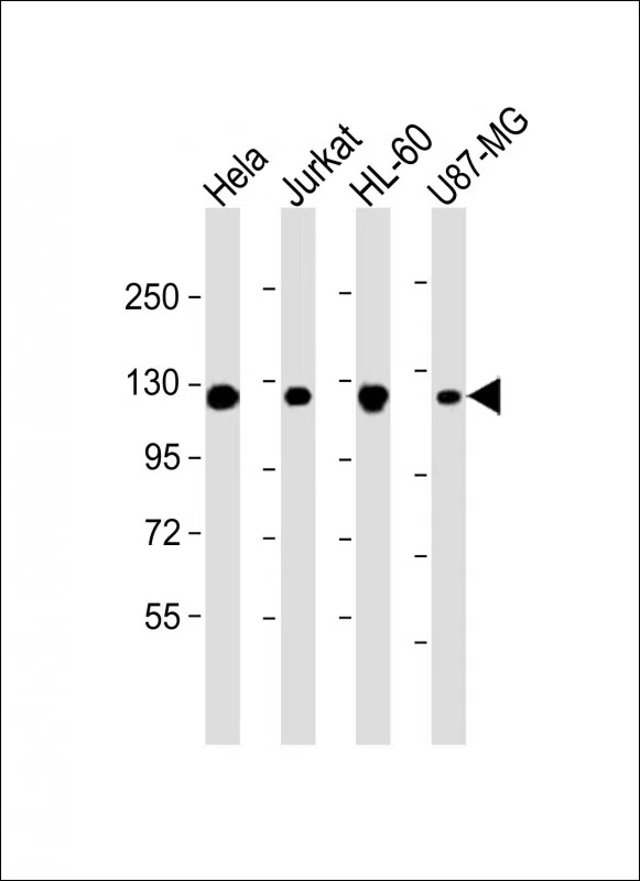 RNF20 Mouse Monoclonal Antibody - Size: 100µl