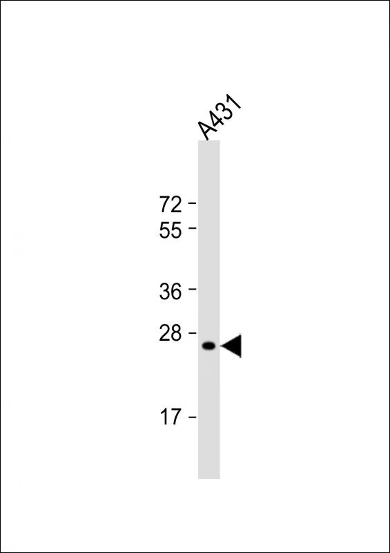 RAB5B Mouse Monoclonal Antibody - Size: 50µl
