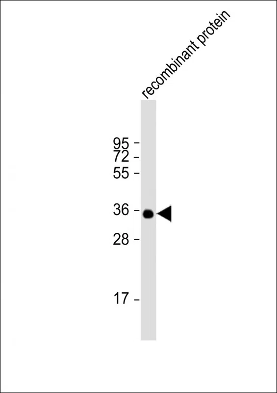 BRCA2 Mouse Monoclonal Antibody - Size: 50µl