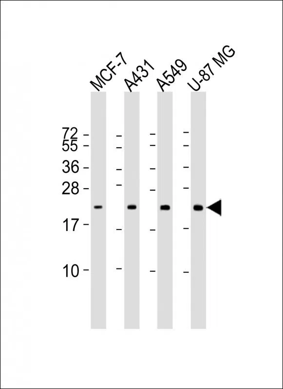 RAB13 Mouse Monoclonal Antibody - Size: 100µl