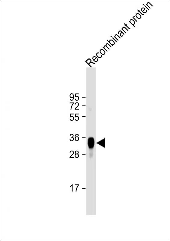 LRP1B Mouse Monoclonal Antibody - Size: 100µl