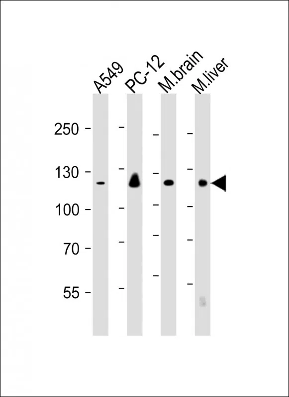 EIF2AK3 Mouse Monoclonal Antibody - Size: 100µl