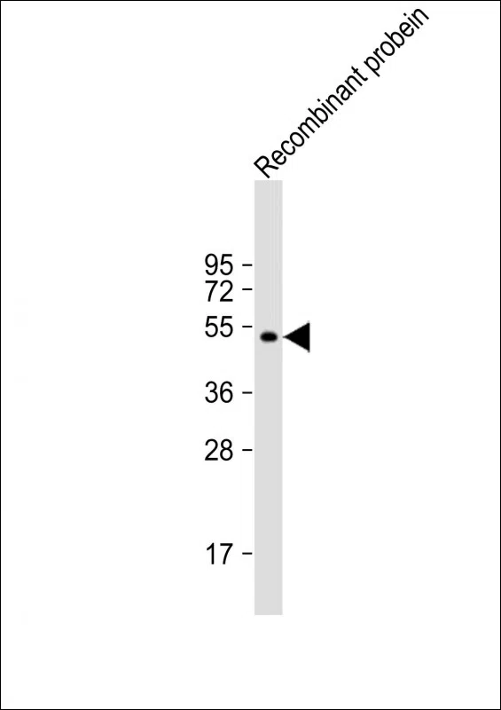 AKAP13 Mouse Monoclonal Antibody - Size: 100µl