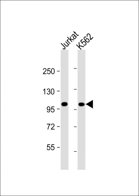 PRDM16 Mouse Monoclonal Antibody - Size: 100µl