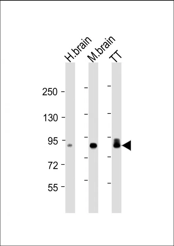 DCLK1 Mouse Monoclonal Antibody - Size: 50µl
