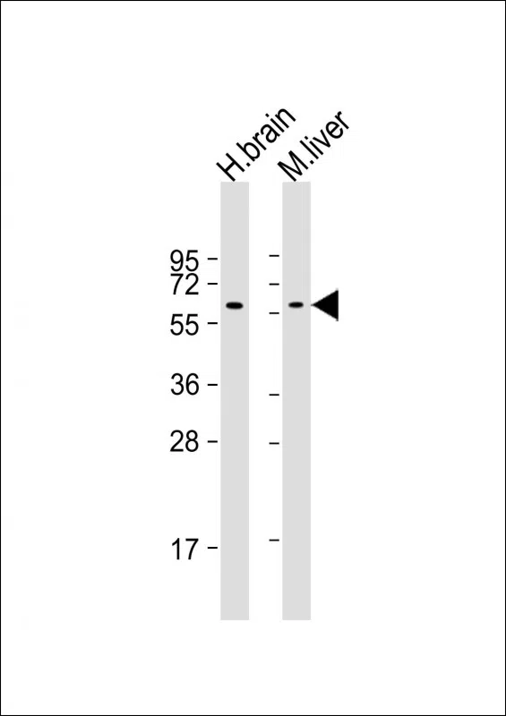 GLS2 Mouse Monoclonal Antibody - Size: 100µl