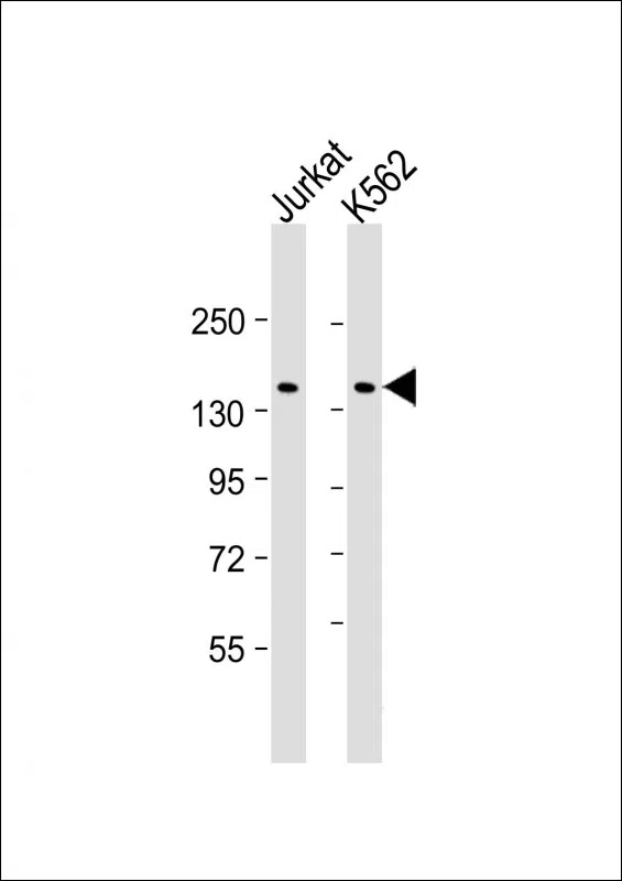 KANK1 Mouse Monoclonal Antibody - Size: 50µl