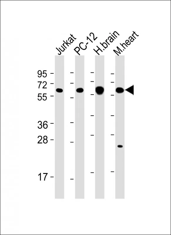 CAMK2 beta Mouse Monoclonal Antibody - Size: 50µl