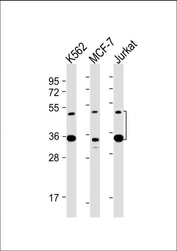MBD2 Mouse Monoclonal Antibody - Size: 100µl