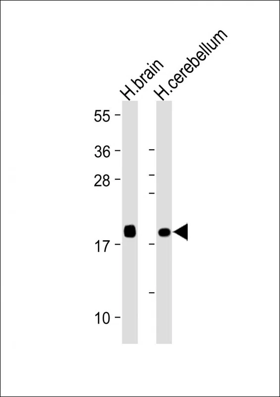 VILIP1 Mouse Monoclonal Antibody - Size: 50µl