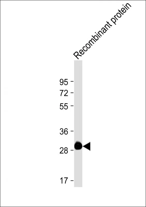 ROS1 Mouse Monoclonal Antibody - Size: 100µl