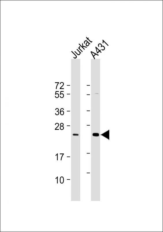 RAB7L1 Mouse Monoclonal Antibody - Size: 100µl