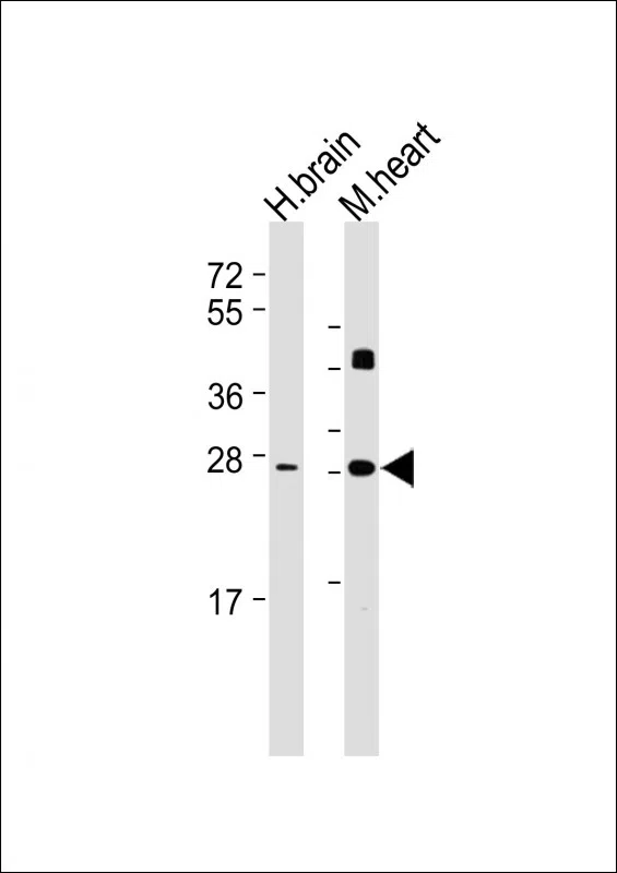 DKK2 Mouse Monoclonal Antibody - Size: 100µl
