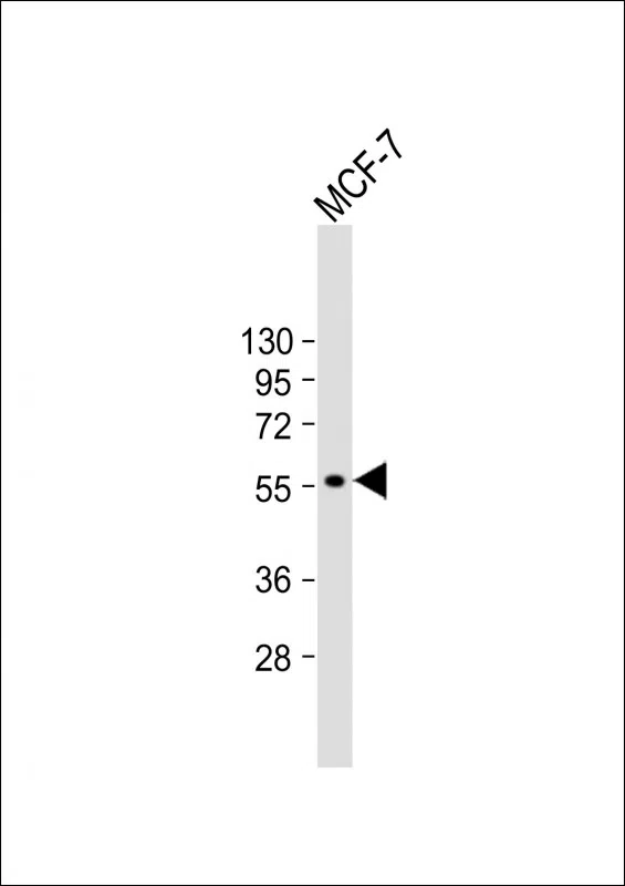 CYP27B1 Mouse Monoclonal Antibody - Size: 100µl