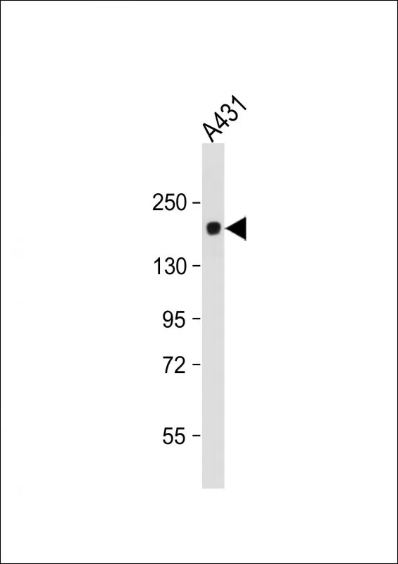 PRDM10 Mouse Monoclonal Antibody - Size: 50µl
