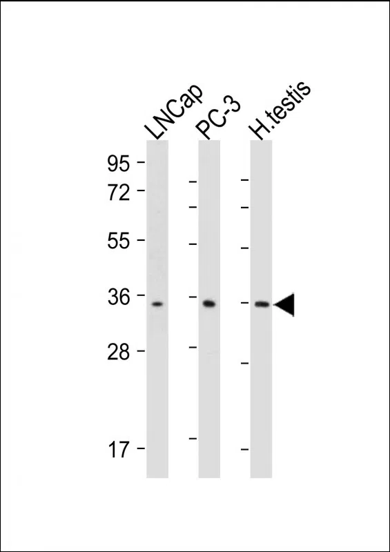 RNF4 Mouse Monoclonal Antibody - Size: 50µl